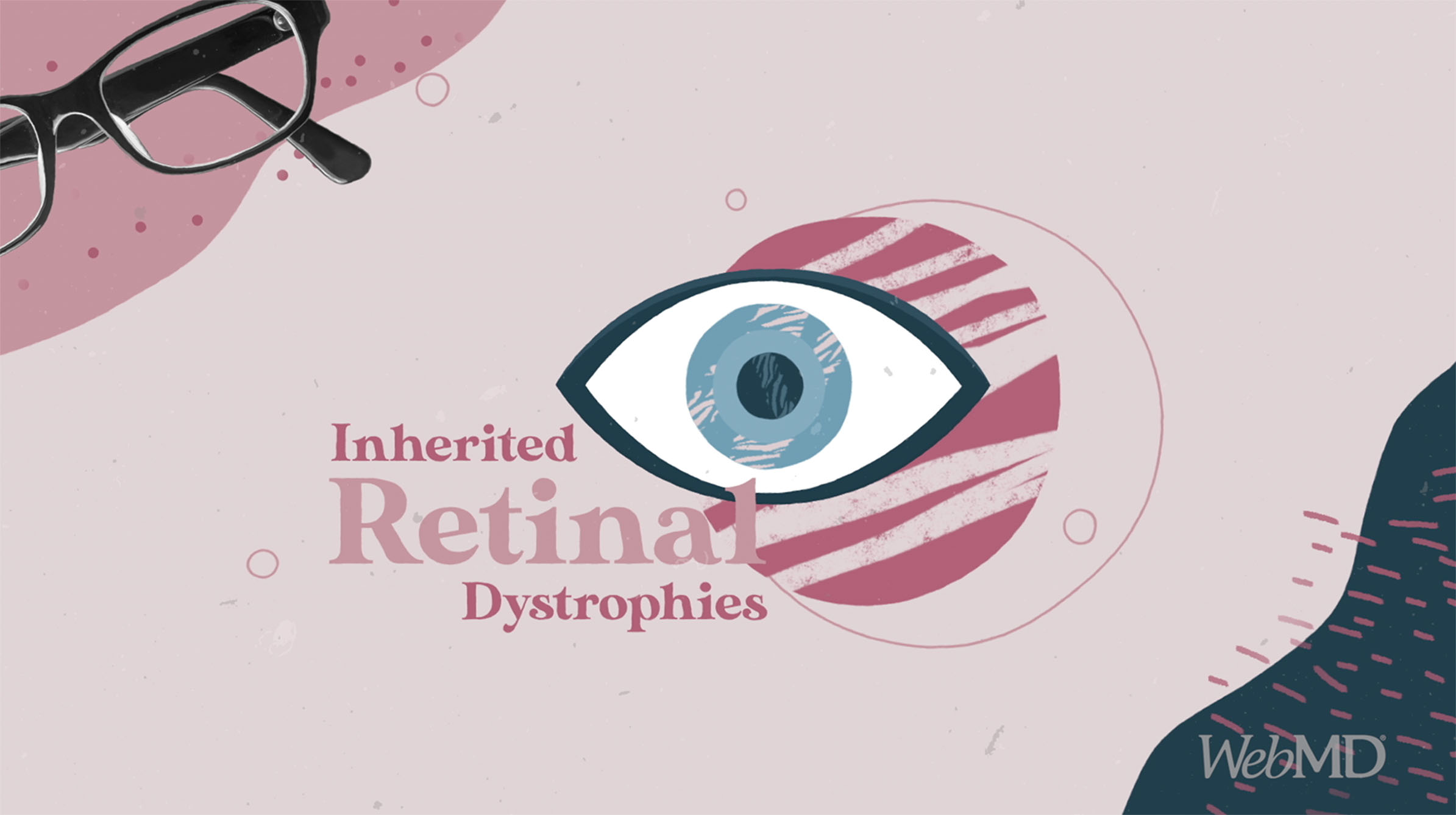 Inherited Retinal Dystrophies
